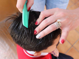 how to treat head lice