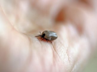 Một vết cắn của bọ chét trông như thế nào trên cơ thể người?